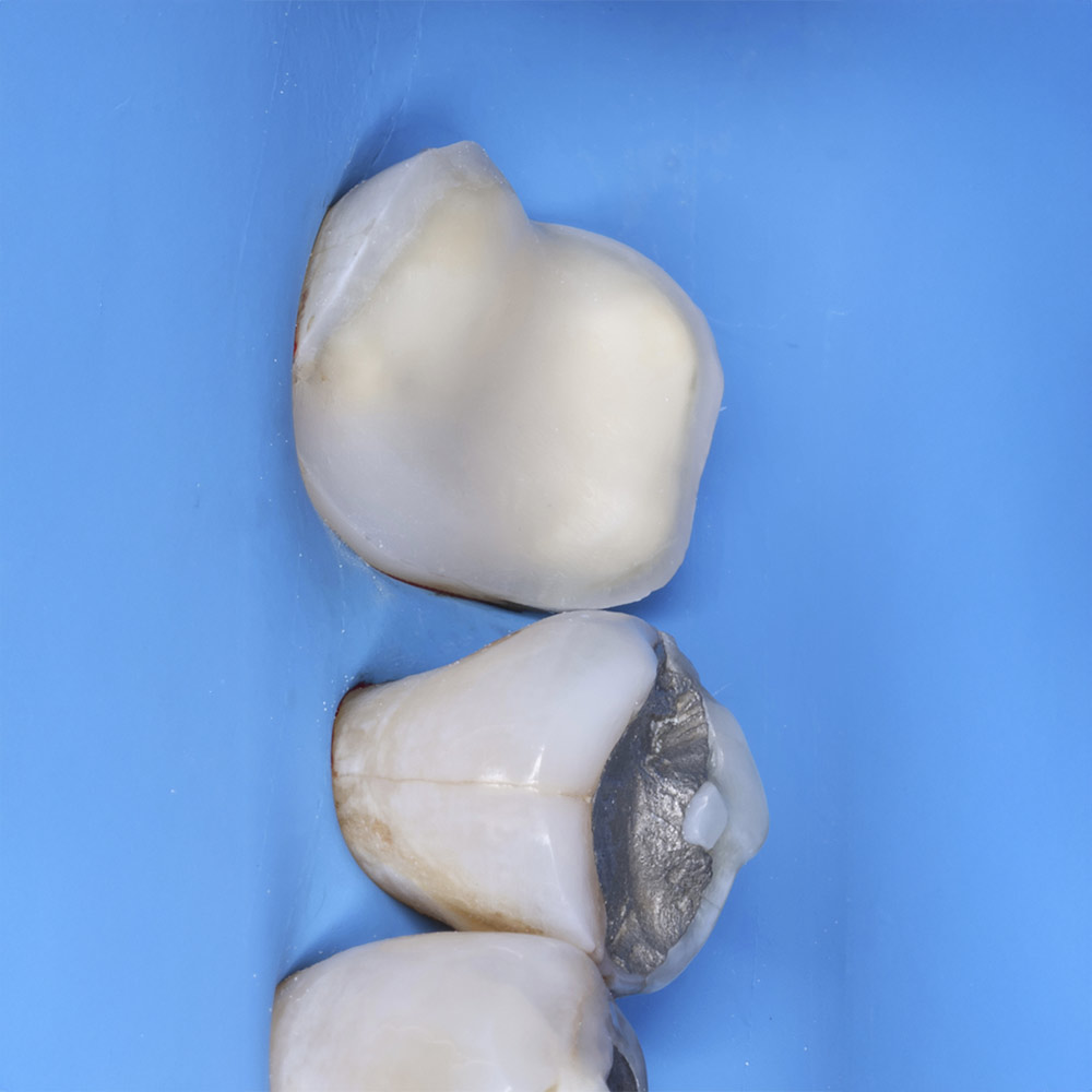 Elevación-de-Margen--(DME)-1